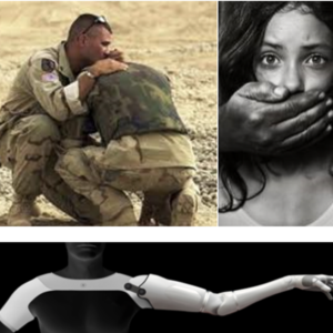 12- HOURS POST TRAUMATIC STRESS & ANXIETY DISORDERS AND PHANTOM LIMB PAIN