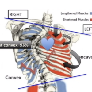 12-Hour MASSAGE THERAPY FOR SPINAL CURVATURES